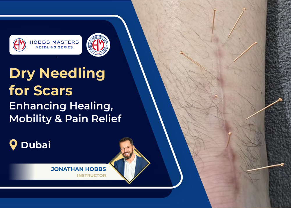 Dry Needling for Scars - Enhancing Healing, Mobility & Pain Relief